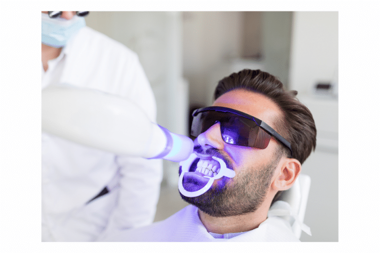clareamento dental laser